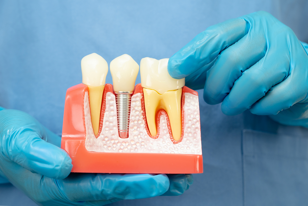 Dental implant consultation room