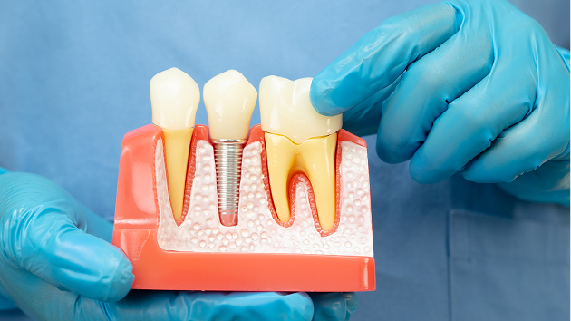 Restorative Procedures